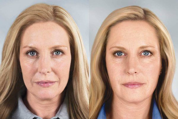 7 главных правил макияжа, которые помогут скрыть любые несовершенства кожи